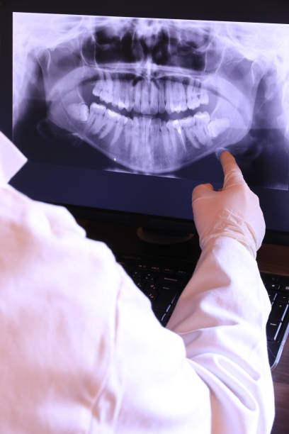 Best Emergency Treatment for Dental Infections or Abscesses in Lakewood Park, FL